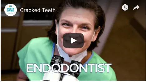 Cracked Teeth Endodontist Video Cover