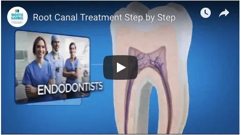 Video Cover Root Canal Treatnment